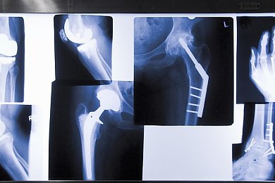 男生把女生困在女生困的：心理战术揭秘：巧妙布局，教你轻松捕获女生芳心-3